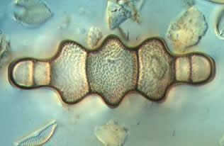 diatom