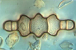 Diatom